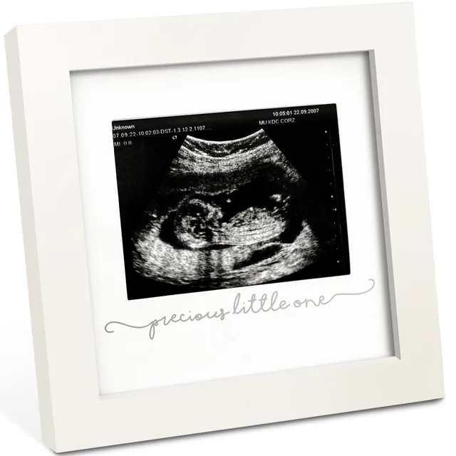keababies-solo-baby-ultraschallbilderrahmen-aus-holz image 1