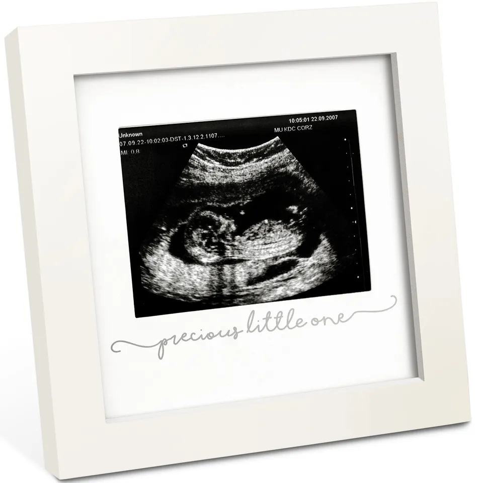 keababies-solo-baby-ultraschallbilderrahmen-aus-holz image 1
