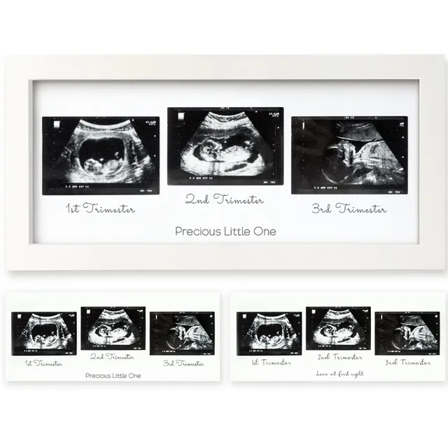 keababies-trio-baby-sonogram-frame-ultraschallbilderrahmen image 1