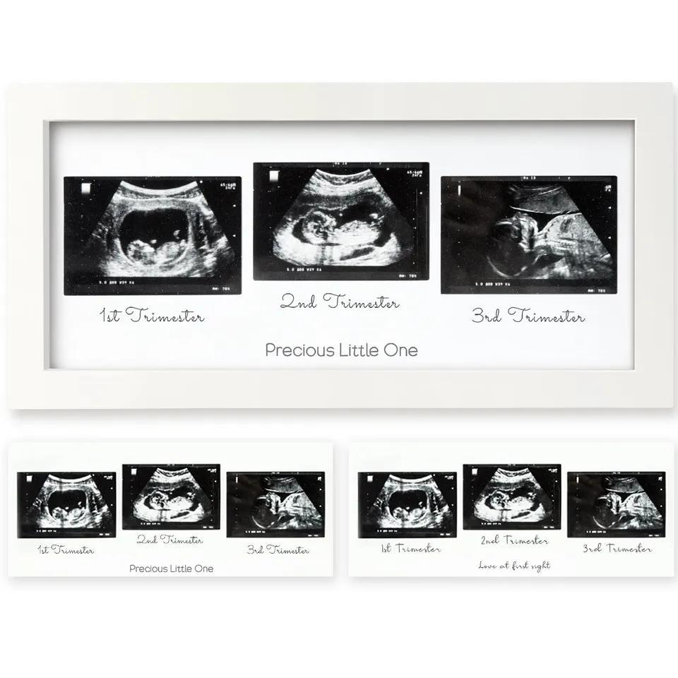 keababies-trio-baby-sonogram-frame-ultraschallbilderrahmen image 1